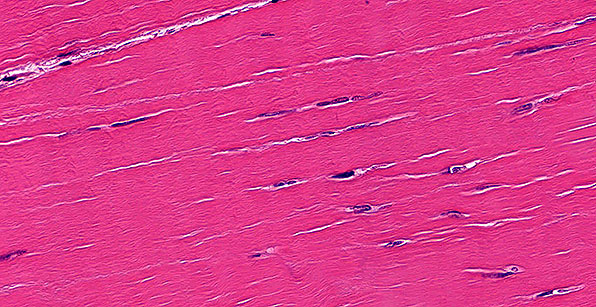 Essential Human Biology : Cells & Tissues : Connective Tissue