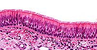 Pseudo-stratified Columnar