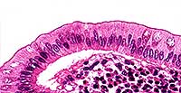 Simple Columnar Cells