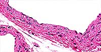 Simple Squamous Cells