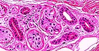 Stratified Cuboidal