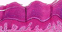 Stratified Squamous Keratinised