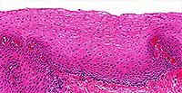 Stratified Squamous