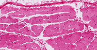 Connective Tissue Coverings of Skeletal Muscle