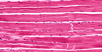 Skeletal Muscle Tissue