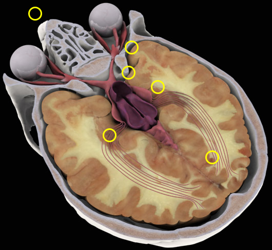 Horiontal cross-section of a human brain